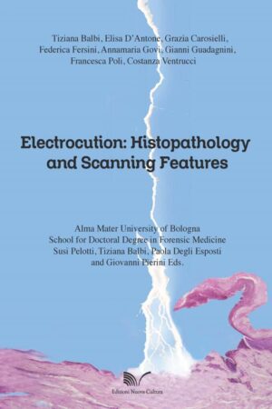 Electrocution